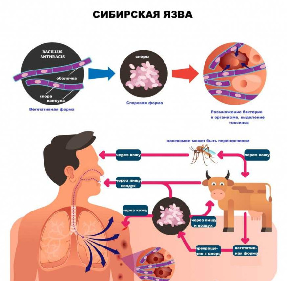 Внимание! Сибирская язва!. Внимание! Сибирская язва!.